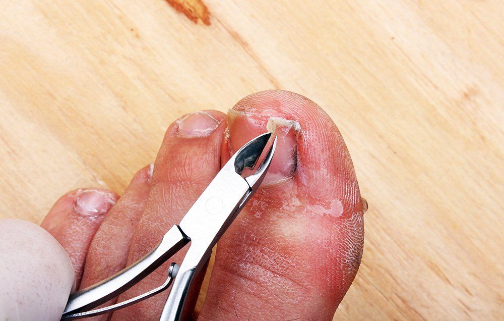 how to clip your toenails 