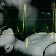 cardiac arrest during sex