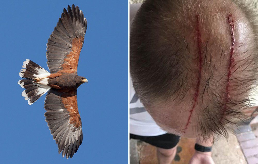 man attacked by hawk jogging
