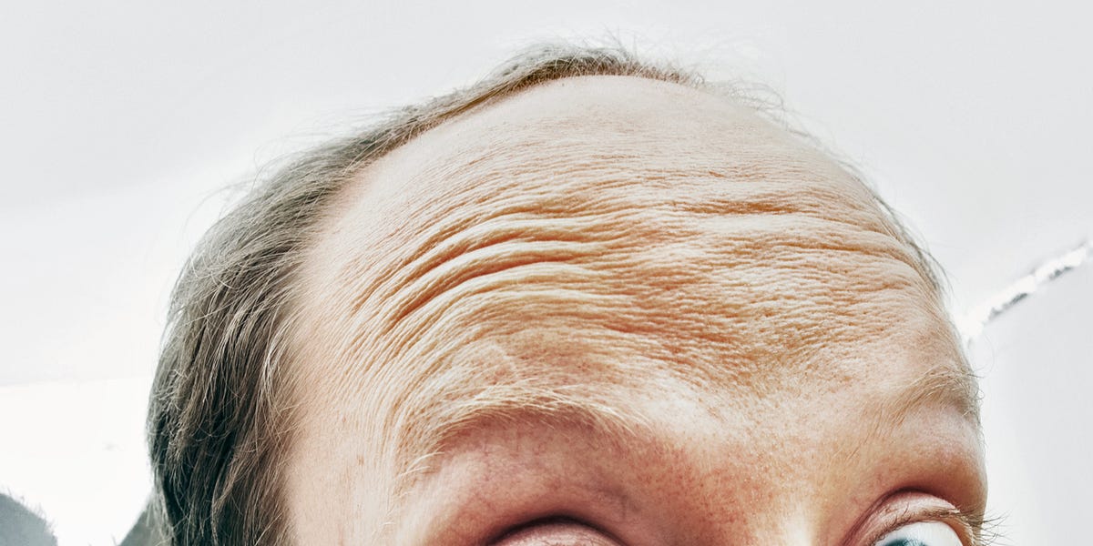 Early Balding and Gray Hair Linked to Heart Disease | Men's Health Early Balding and Gray Hair Linked to Heart Disease | Men's Health
