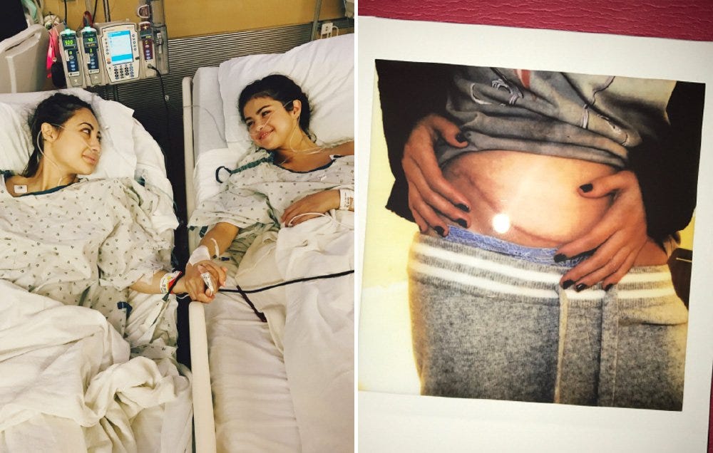 Selena Gomez Receives a Kidney Transplant Due to Lupus | Men's Health