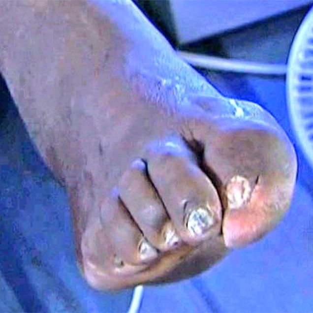 shaq foot