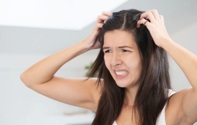 6 Things to Know if You're Dealing with Dandruff | Women's Health