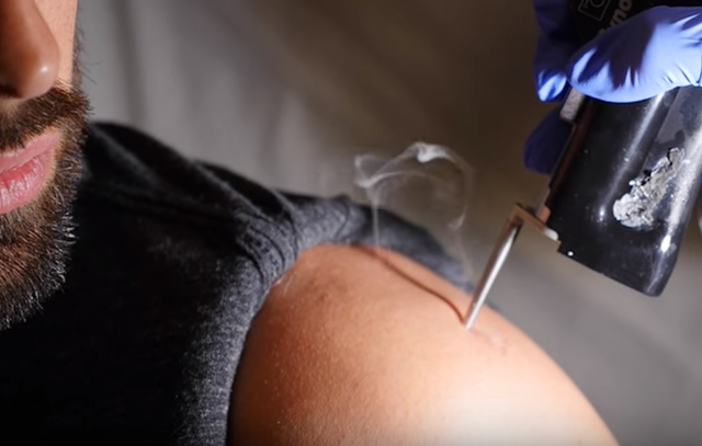 You Won t Be Able to Look Away from This Slo Mo Laser Hair Removal