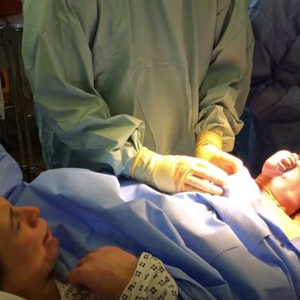 Watch As This Baby Wiggles His Own Way Out Of His Mom During A 'Natural C- Section' Birth
