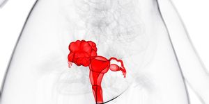 uterine cancer lynch syndrome