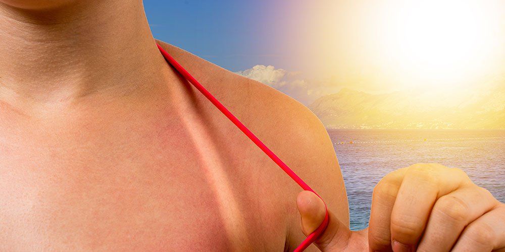 Anti-Sunscreen and Tanning Tips Trending on Social Media, Experts Debunk Popular Myths
