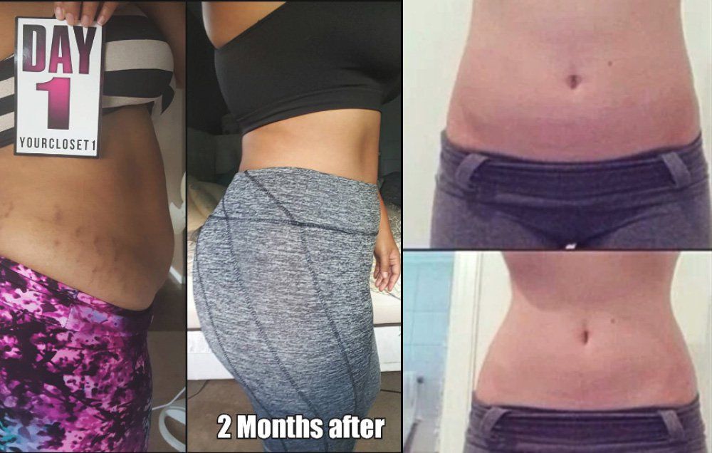 Amazing Results in 10 days! The waist-trainer is the perfect tool