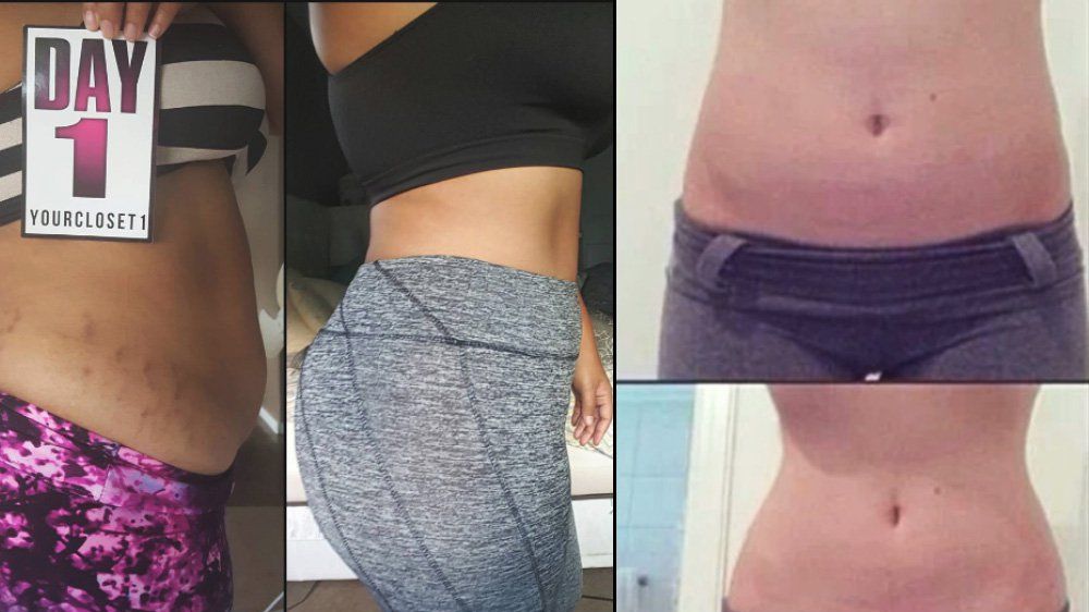 Gallery For > Waist Training Results Before And After