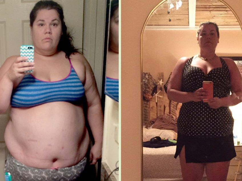Gastric Balloon Procedure Helped This Woman Drop 70 Lbs. Without Surgery