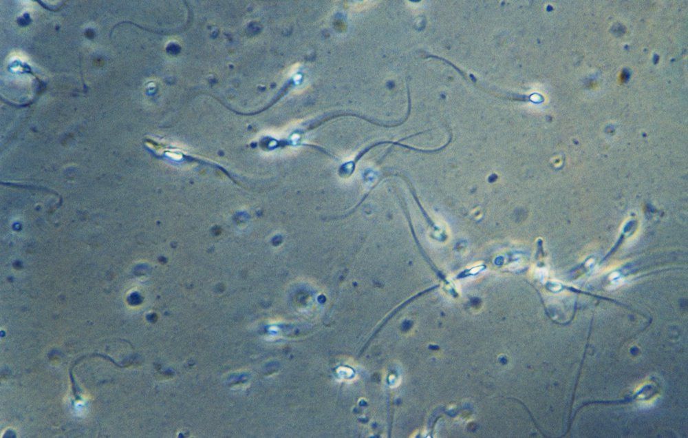 Youll Never Guess What Researchers Found Living In Semen Womens Health 27 Viruses Found In Semen