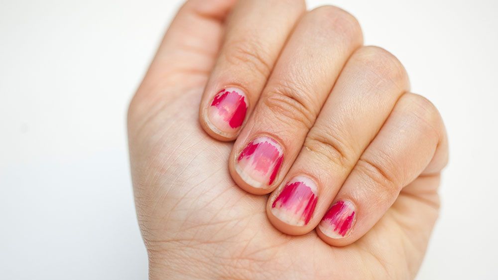 Chipped Nail Polish: Surprising Reasons Why Your Polish Keeps Chipping