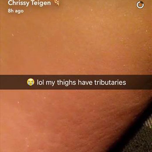 Chrissy Teigen Stretch Marks