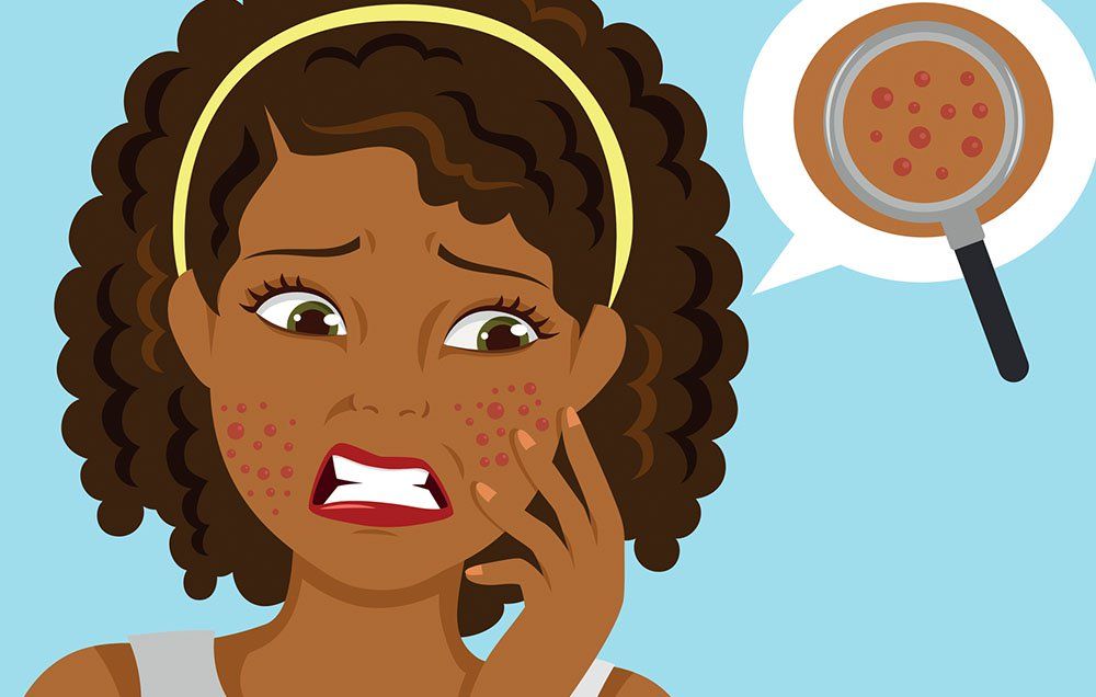 Dr. Pimple Popper: How To Treat Oily Skin | Women's Health Dr. Pimple Popper: How To Treat Oily Skin | Women's Health