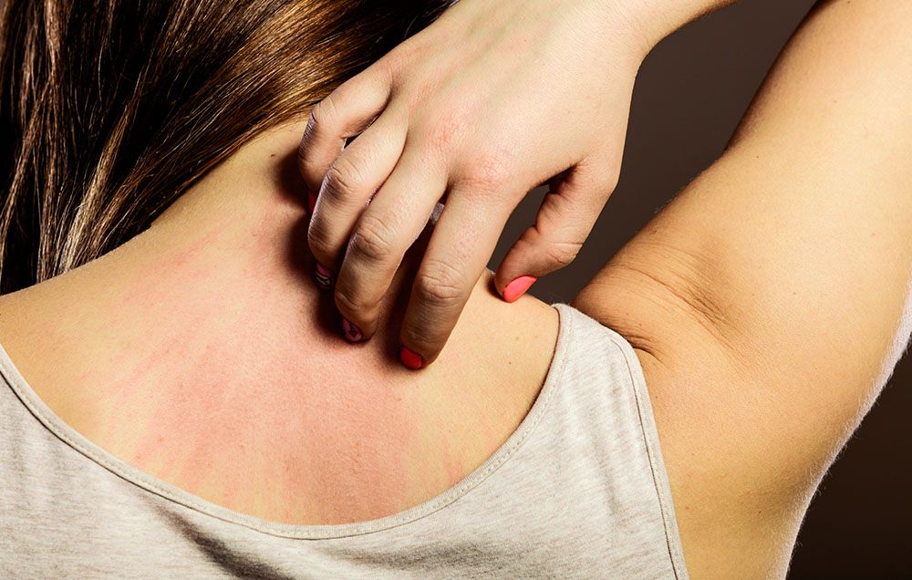 Do You Have Psoriasis Or Just Really Dry Skin?