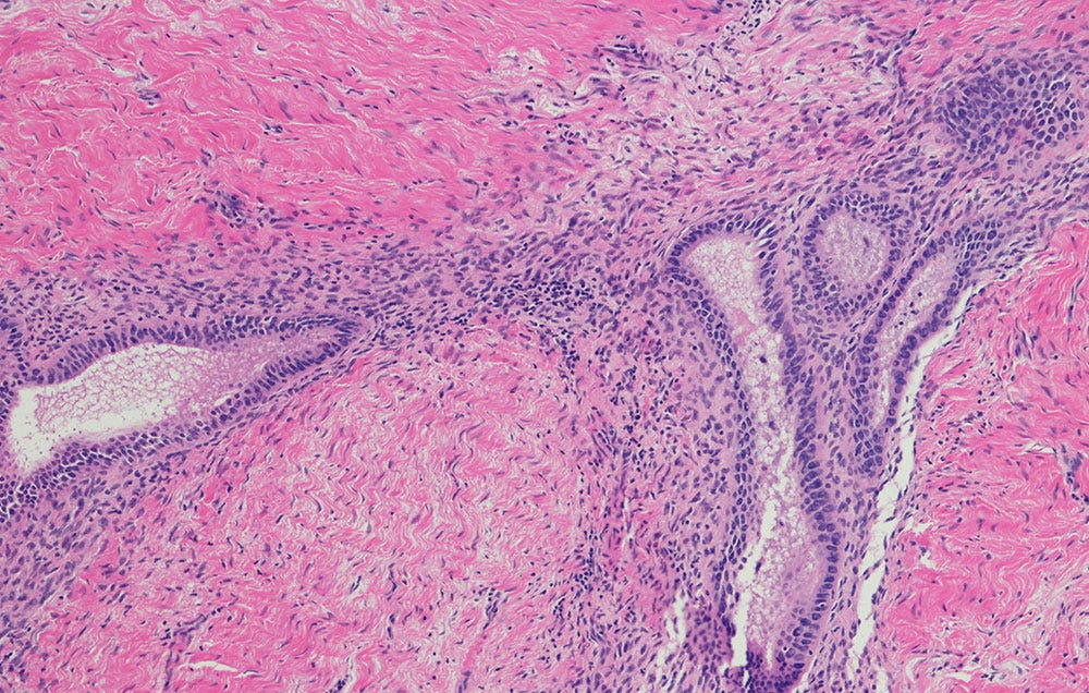 5 Signs You Might Have Endometriosis And Not Even Know It