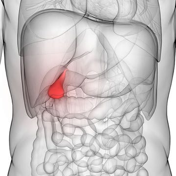 Gallstone symptoms