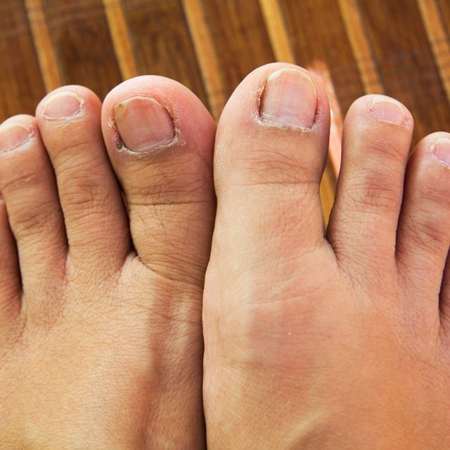 How To Avoid Cuts Under the Big Toe in Yoga