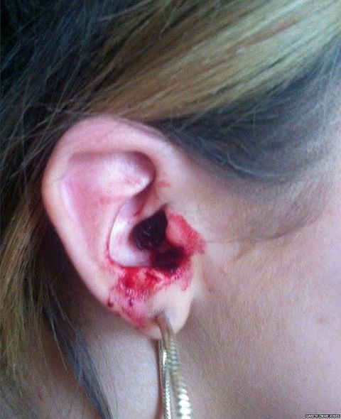 marnie-rae's bleeding ear