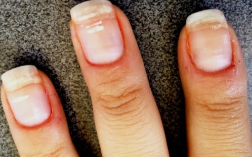 8 Weird Things That Can Happen to Your Fingernails—and What They Say About  Your Health | Women's Health