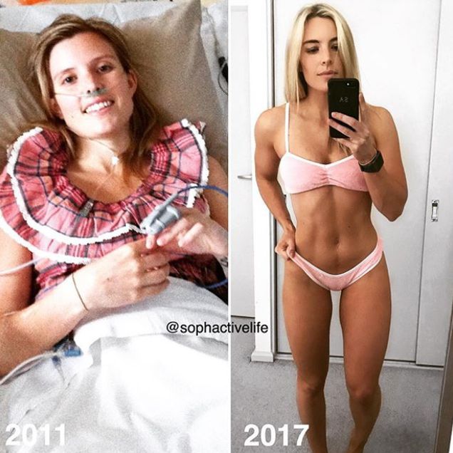 Sophie Allen Transformation