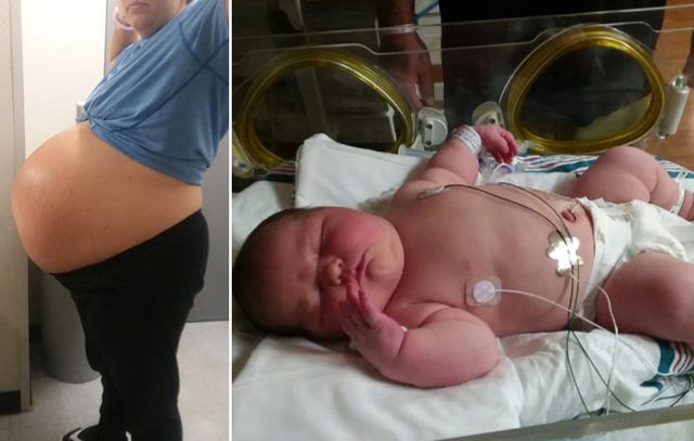 Baby born weighing 12 ounces at birth heads home from Florida hospital