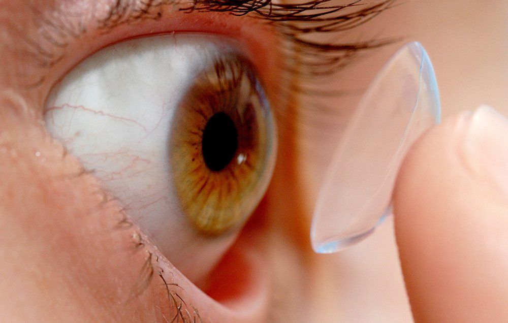Woman lost 27 contacts in eye