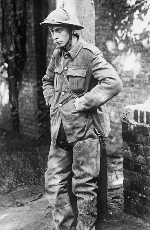 Deze Britse soldaat werd in 1918 krijgsgevangen gemaakt door de Duitsers en had hersenletsel opgelopen dat als shellshock werd omschreven Het letsel was waarschijnlijk te wijten aan een uniek patroon van littekenweefsel in zijn brein
