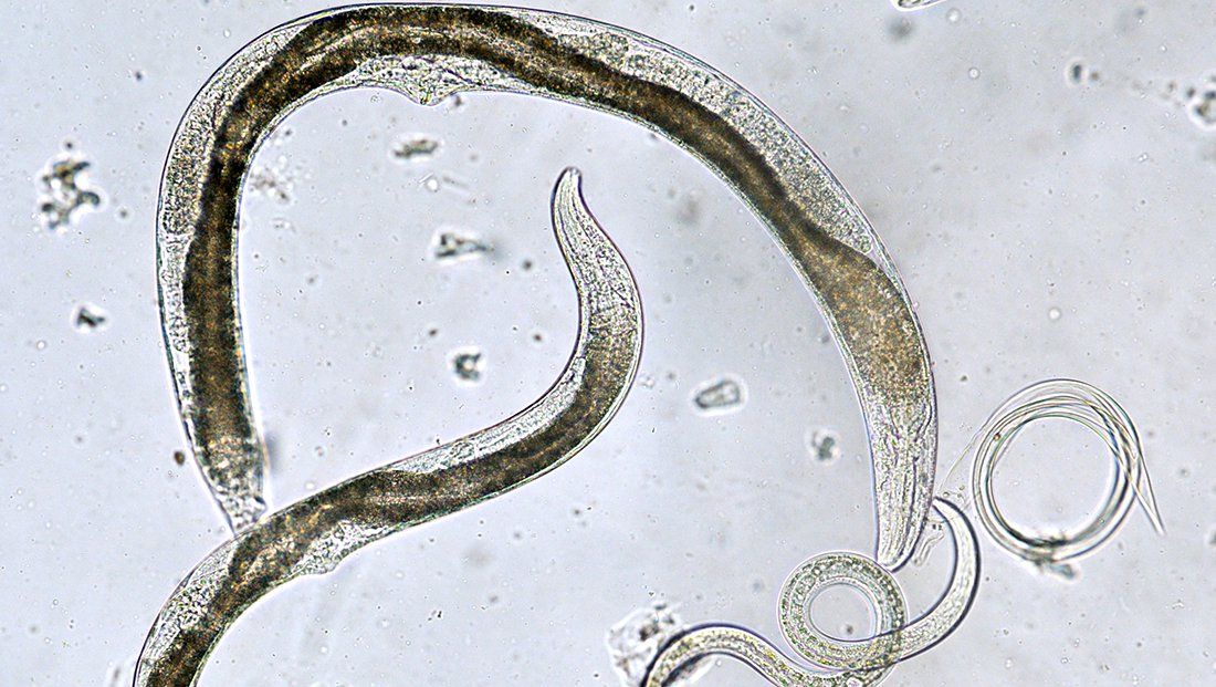 What Are Nematodes? These Tiny Worms Can Help or Hurt Your Garden
