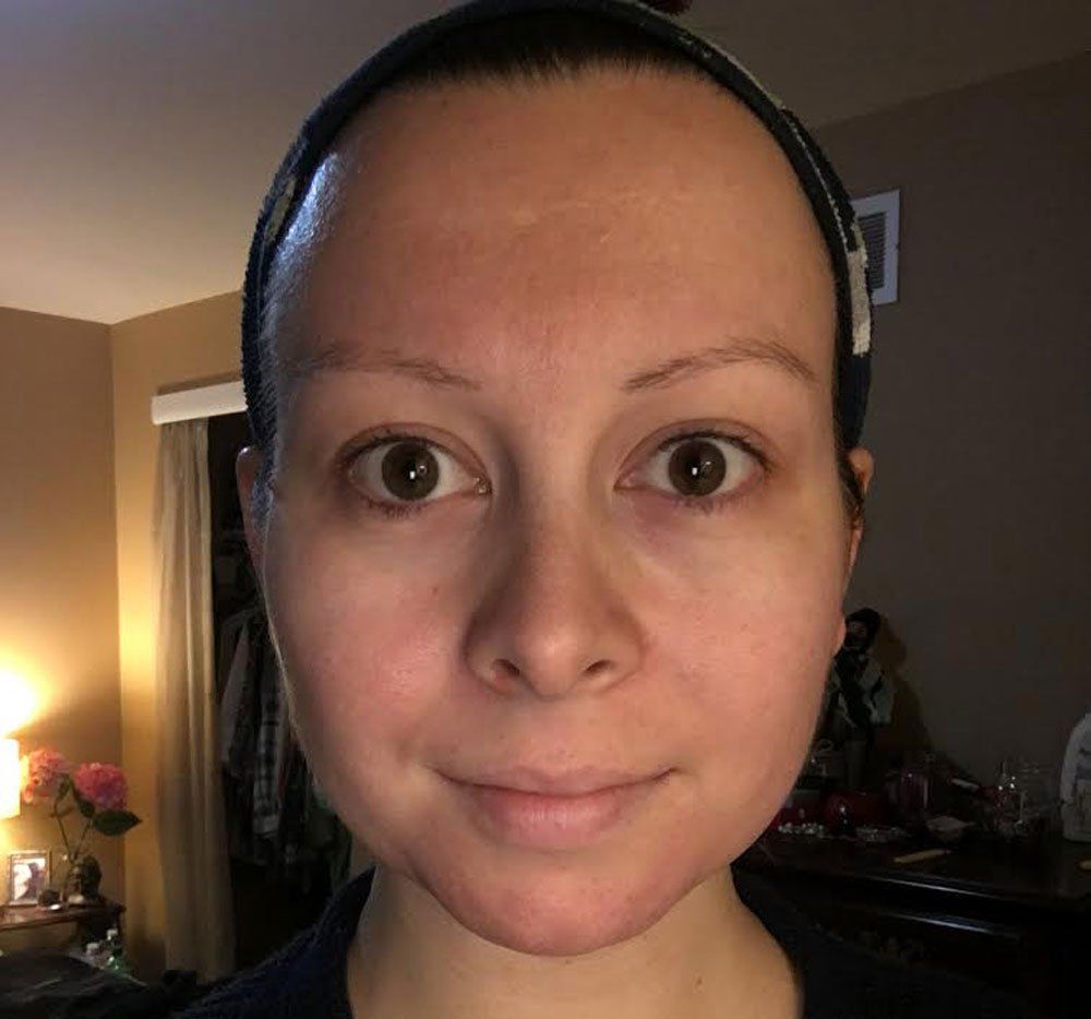 Lemon water skin 2024 before and after