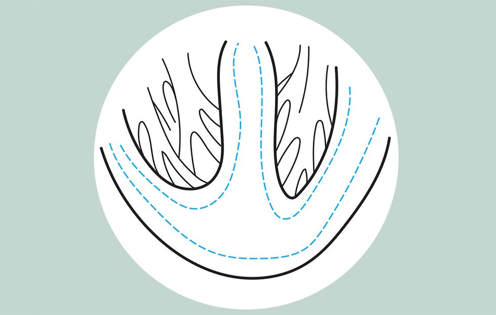 A Change of Heart wider, more abundant coronary capillaries