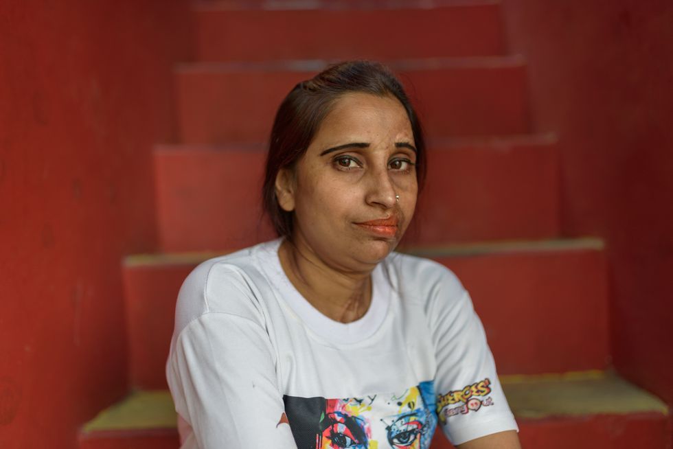 Raukaiya Khatun, 31, was attacked by her sister's brother-in-law who was interested to marry her. She was attacked at the age of 15 in 2002 after she rejected his marriage proposal. Raukaiya is currently married and works at the Shereos Hangout Cafe in Agra.