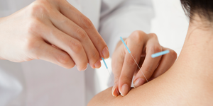 acupuncture for joint pain