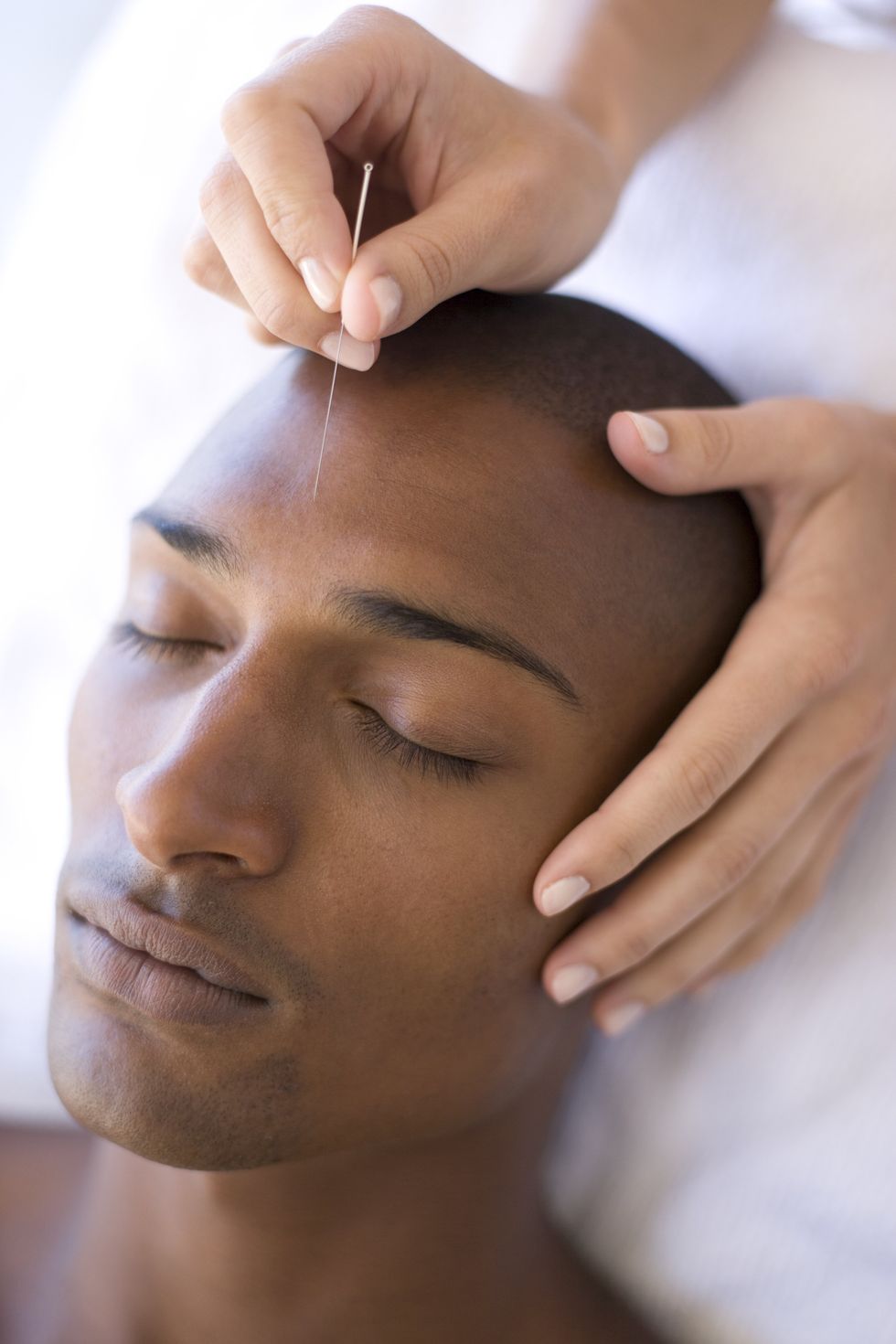 Acupuncturist inserting needle into client forehead