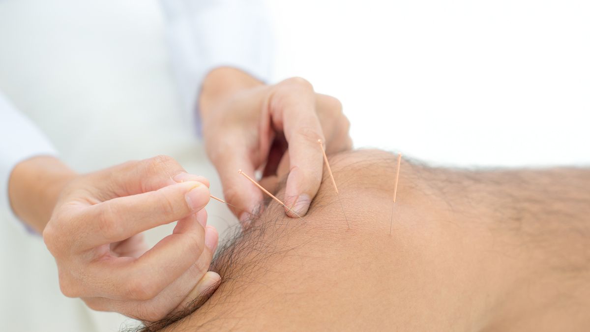 Para qué sirven las agujas de acupuntura? Conoce sus beneficios