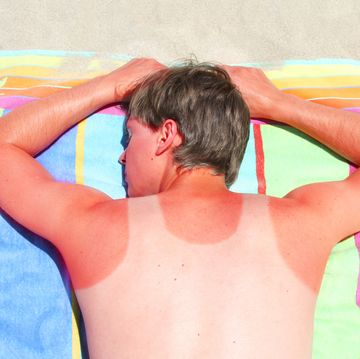 adult male with sunburnt vest mark