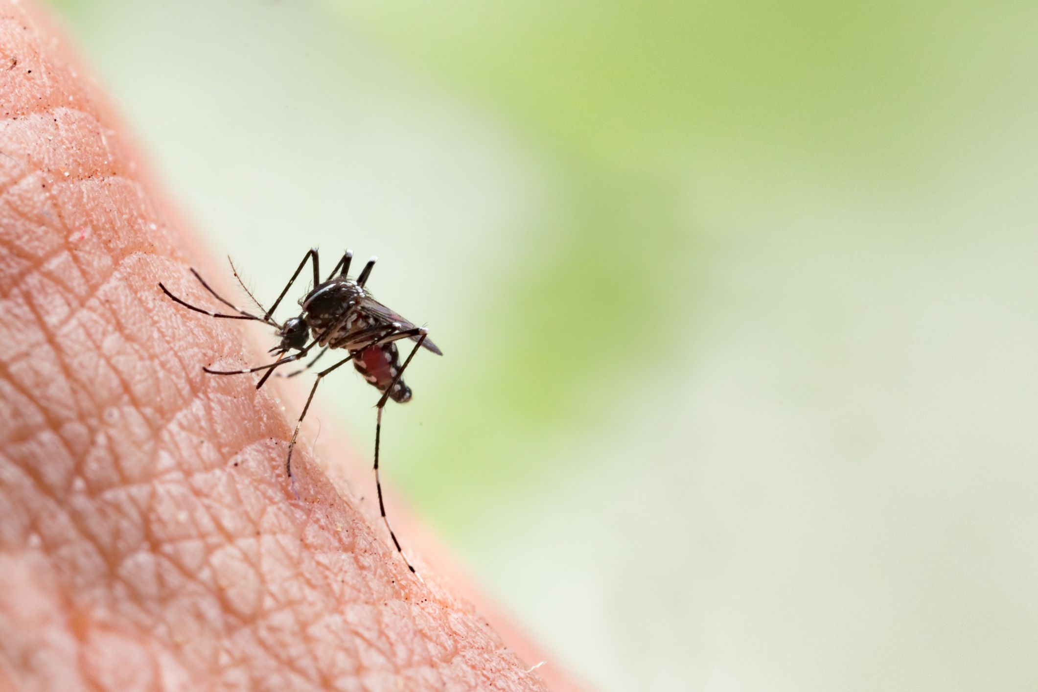 7 Mosquito Bite Home Remedies