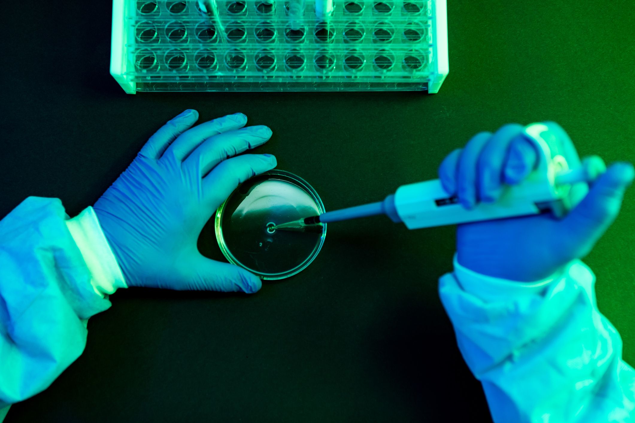 aerial view of the hands of a scientist pouring fluid with the pipette into a petri dish in a laboratory with a green atmosphere
