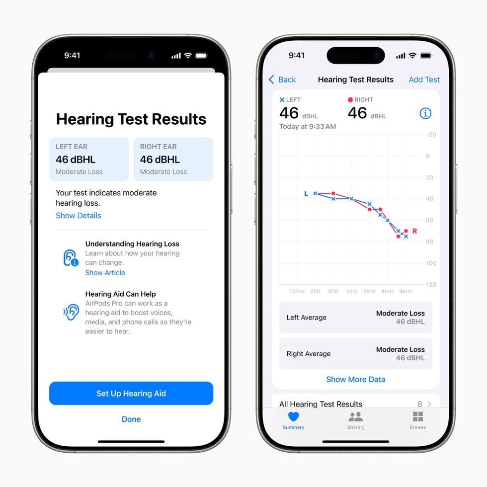 hearing test results displayed on smartphone screenshots showing moderate hearing loss in both ears