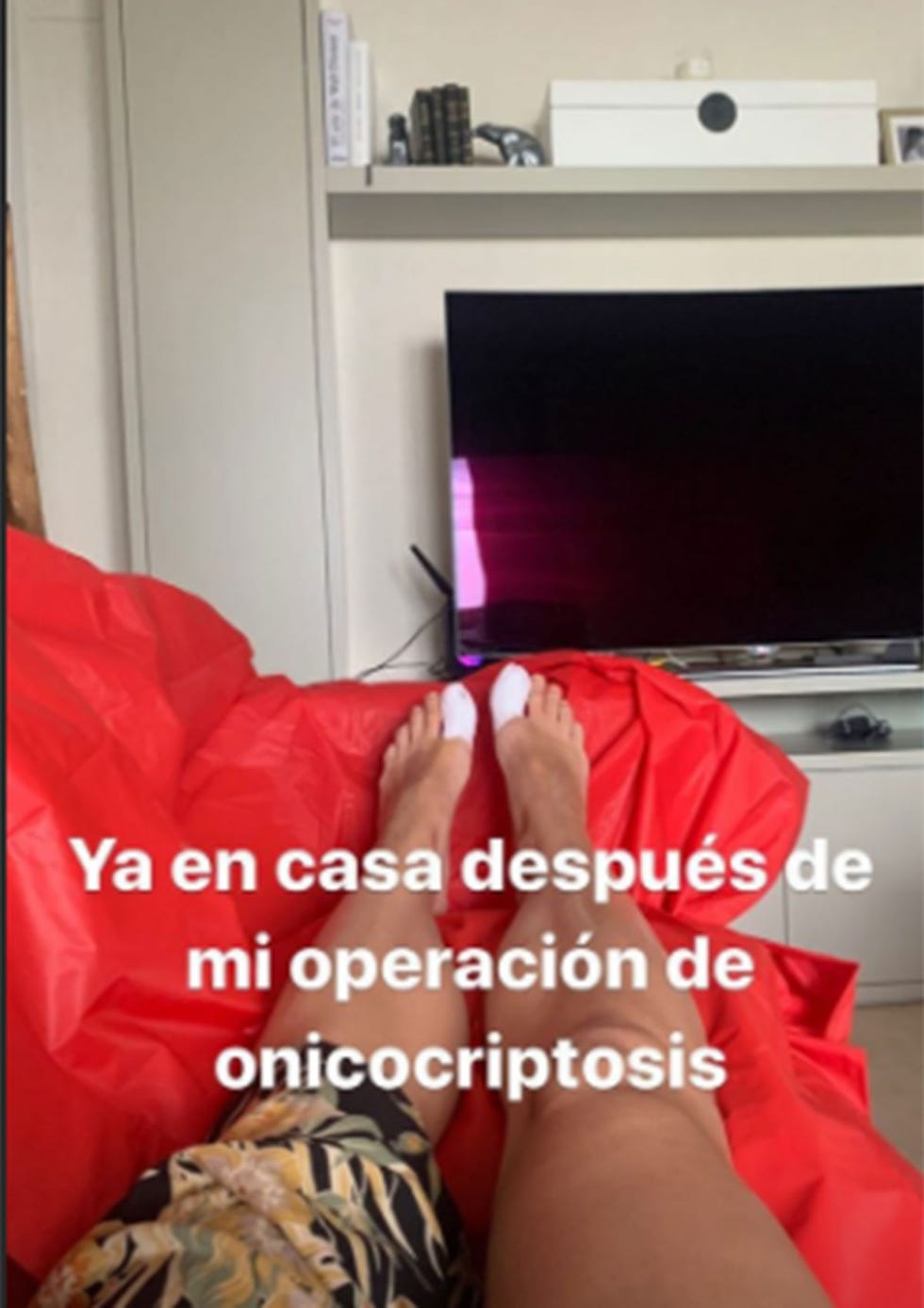 alba carrillo muestra su operación de onicocriptosis
