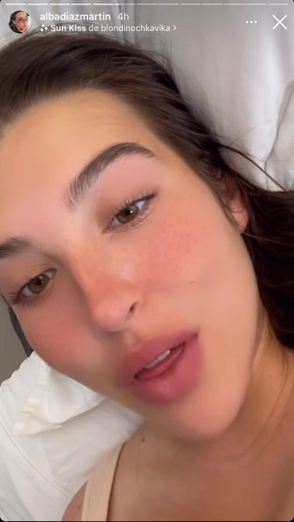 alba díaz habla en instagram tras su operación de pecho