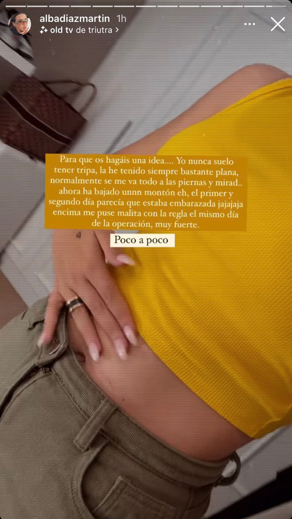 alba díaz se muestra en instagram tras su operación de pecho y habla de su rápida recuperación