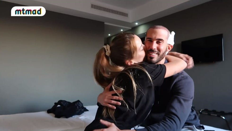 alejadnro bernardos, novio de mayka rivera, de la isla de las tentaciones, se somete a un injerto capilar y muestra el proceso y resultado