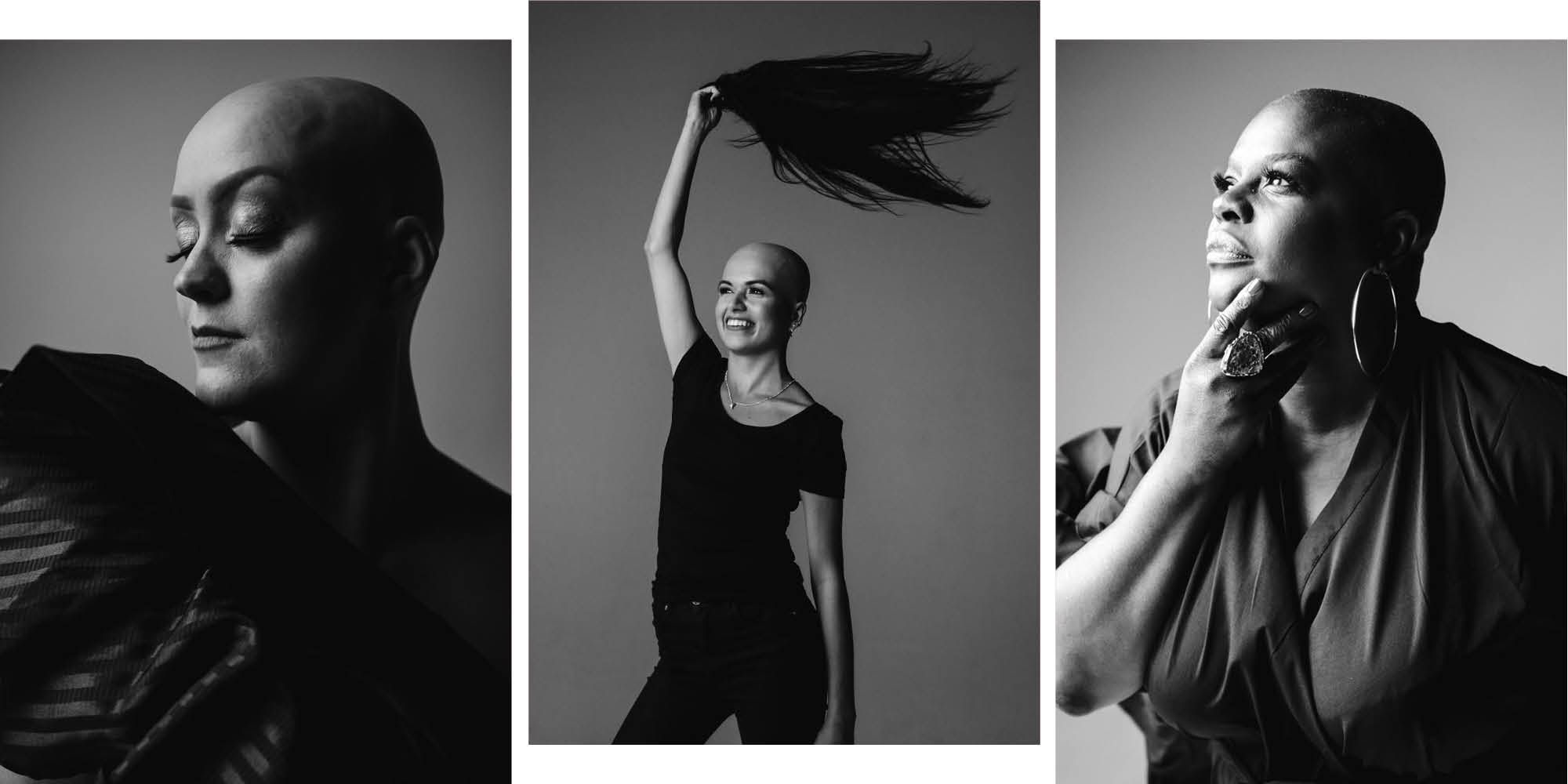 Living with alopecia 6 women share what it s like