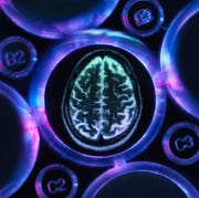 Alzheimers and dementia research, a brain scan in multi well tray used for research experiments in laboratory alzheimers and dementia research, a brain scan in multi well tray used for research experiments in laboratory