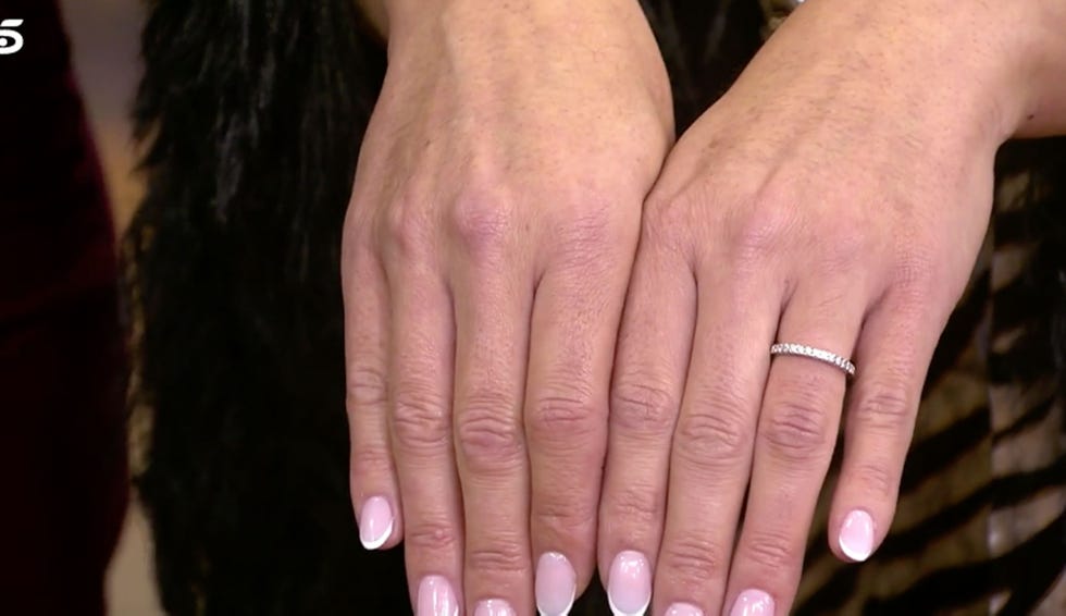 anillo
