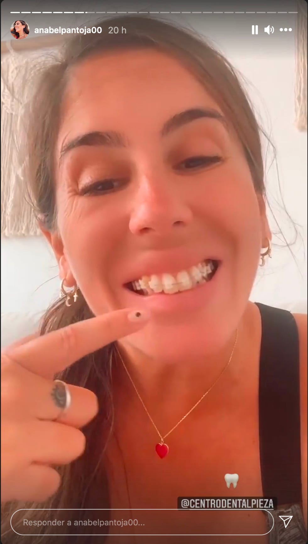 anabel pantoja muestra su nuevo aparato dental