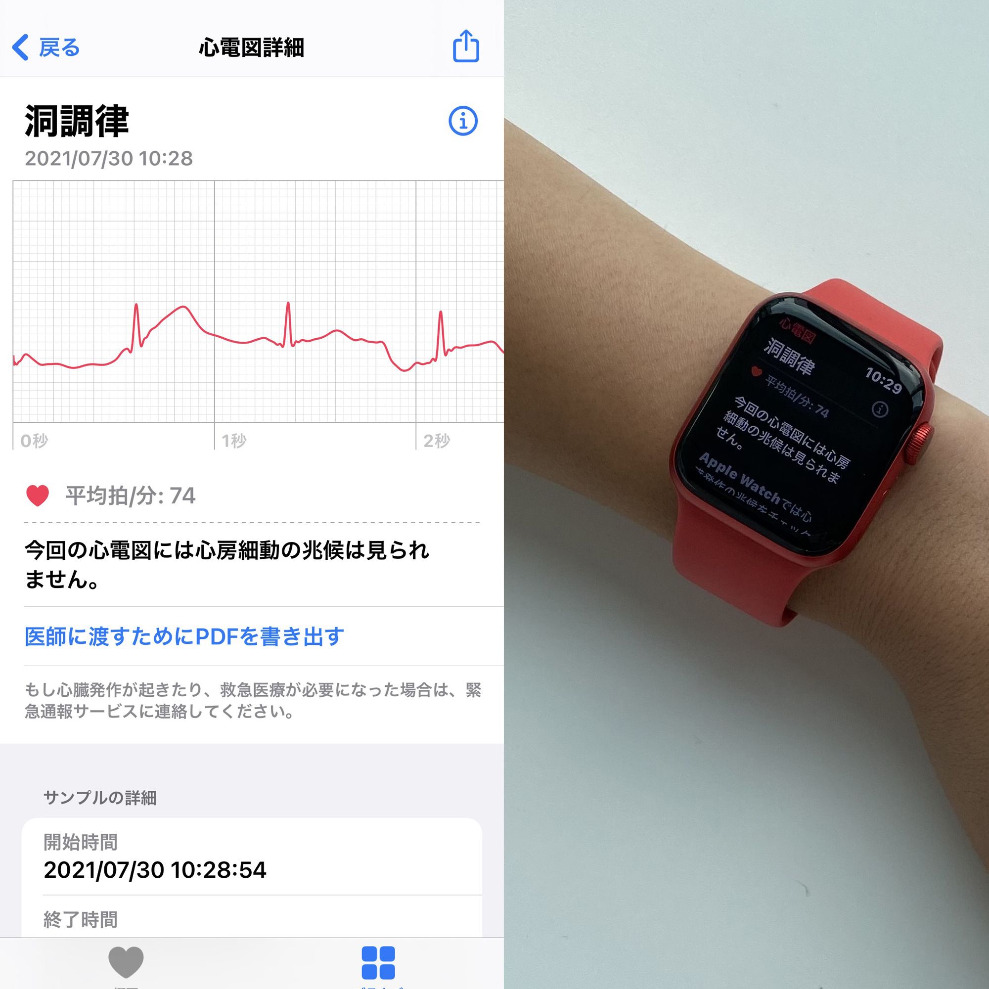 着けているだけで健康に? 心電図の検査はスマートウォッチで 着けているだけで健康に? 心電図の検査はスマートウォッチで