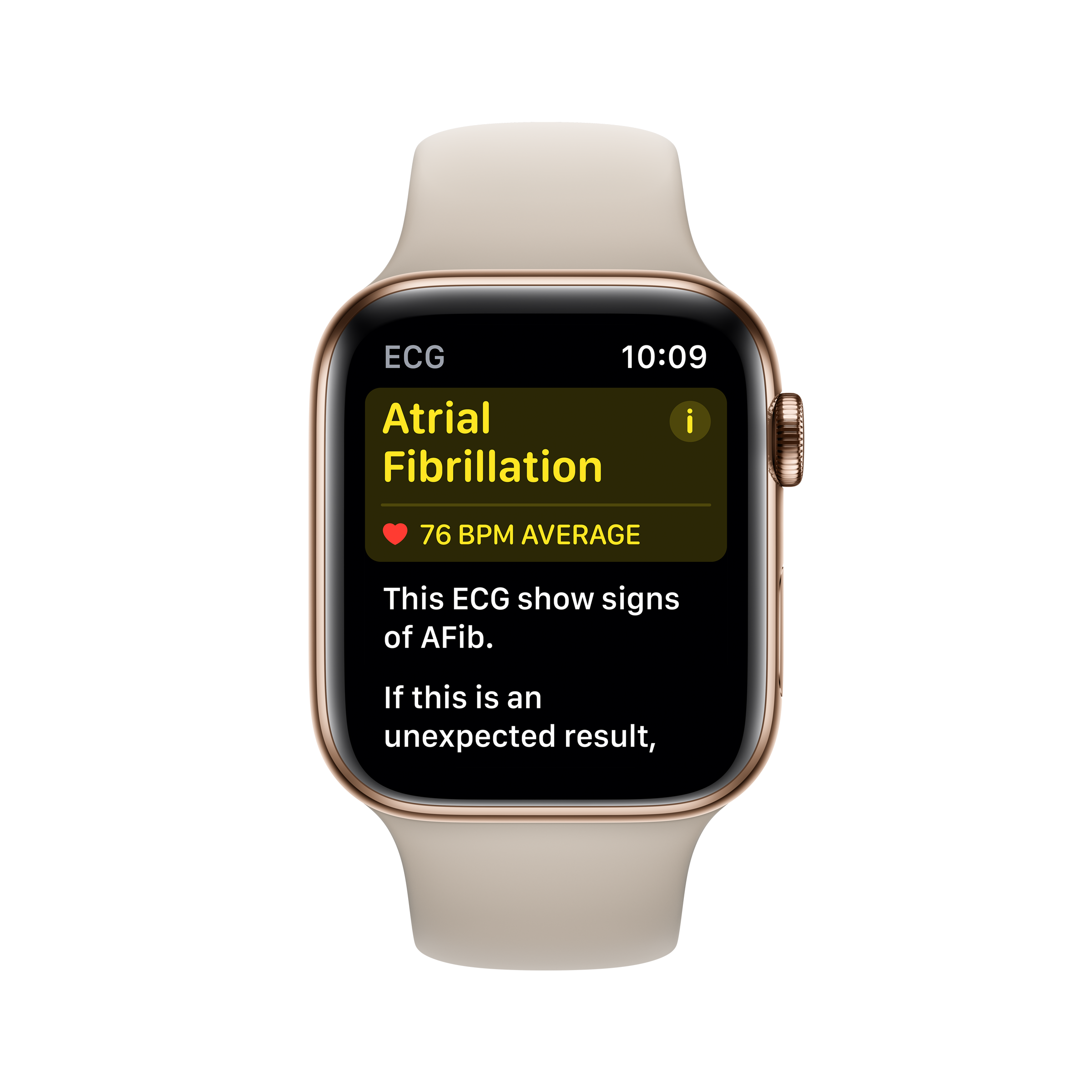 how-to-add-widgets-to-the-apple-watch-in-watchos-10-gadgetany