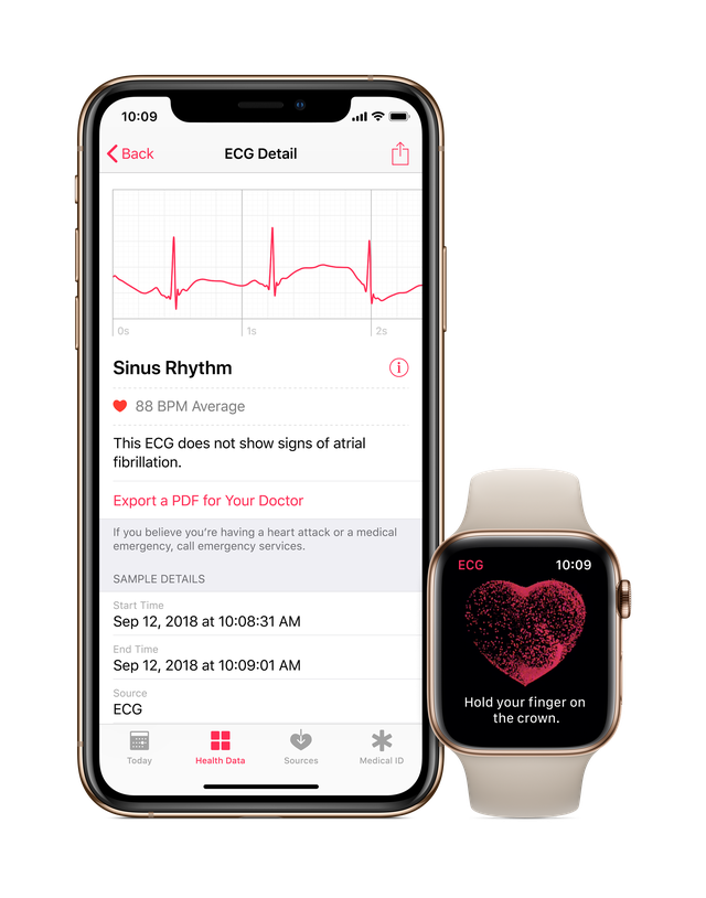 apple watch and iphone heart monitor